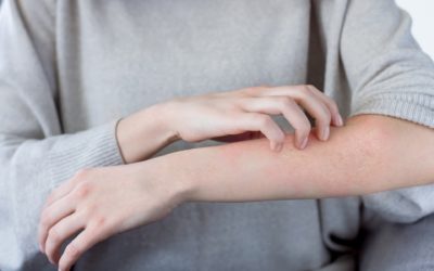 The Best Moisturisers for Dry Skin in 2021