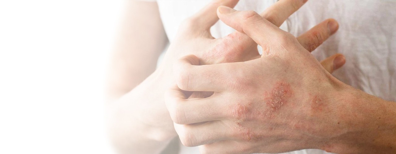 Rosken Moisturiser for Dry Skin